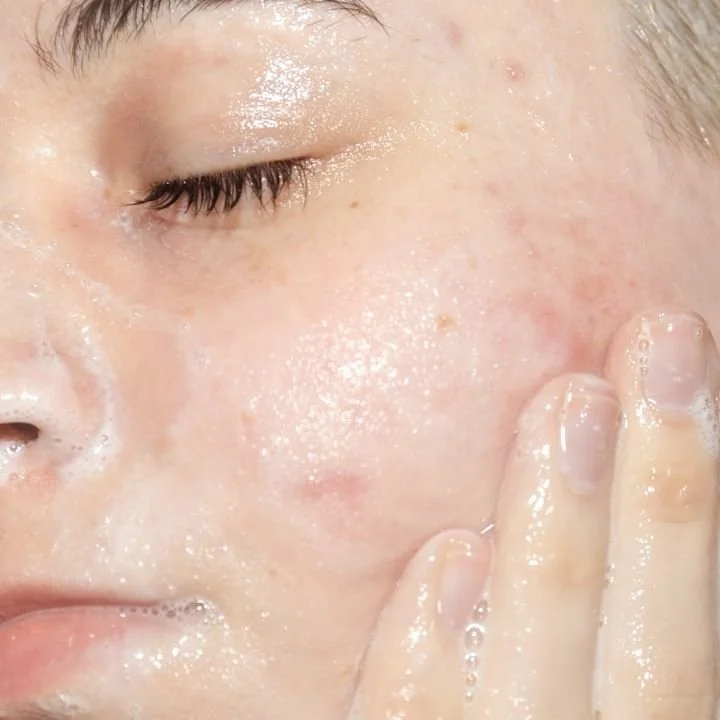 Niacinamida: el ingrediente clave para manchas y piel más uniforme