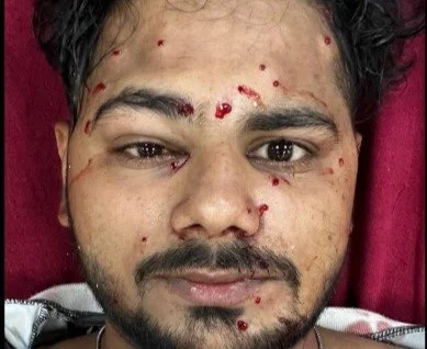 दिल्ली में प्रदर्शनकारियों के खिलाफ पेलेट गन और शॉक बेटन का इस्तेमाल