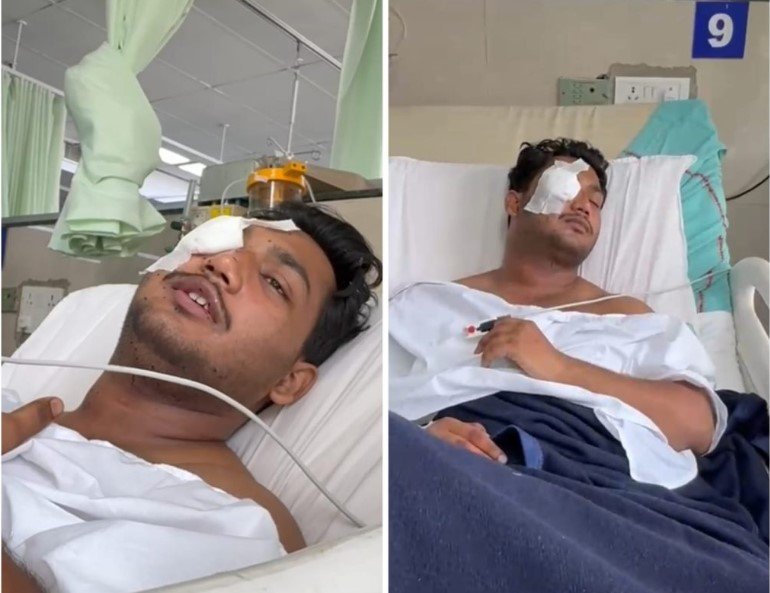डॉक्टरों ने कहा है, पेलेट गन का शिकार हुए पीड़ित की आँख की रोशनी वापस आने की केवल 1% संभावना है