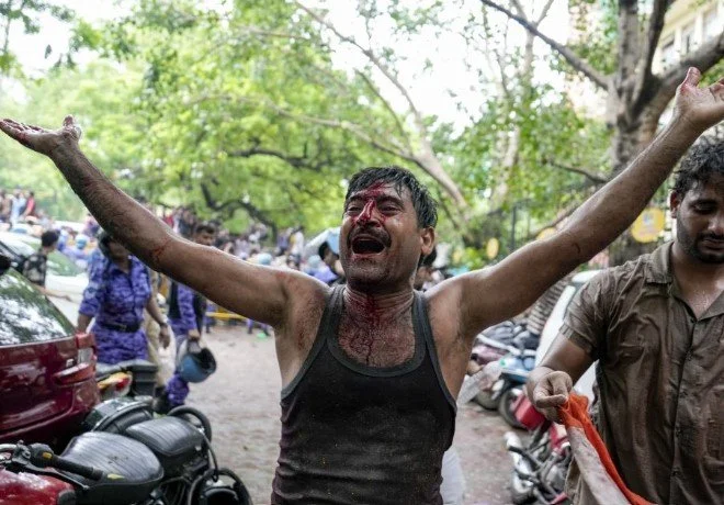 ‘मौत तो दूर की बात, एक भी व्यक्ति की हड्डी नहीं टूटी’, ‘दिल्ली पुलिस की तारीफ होनी चाहिए’: रिजिजू ने कहा&nbsp;&nbsp;