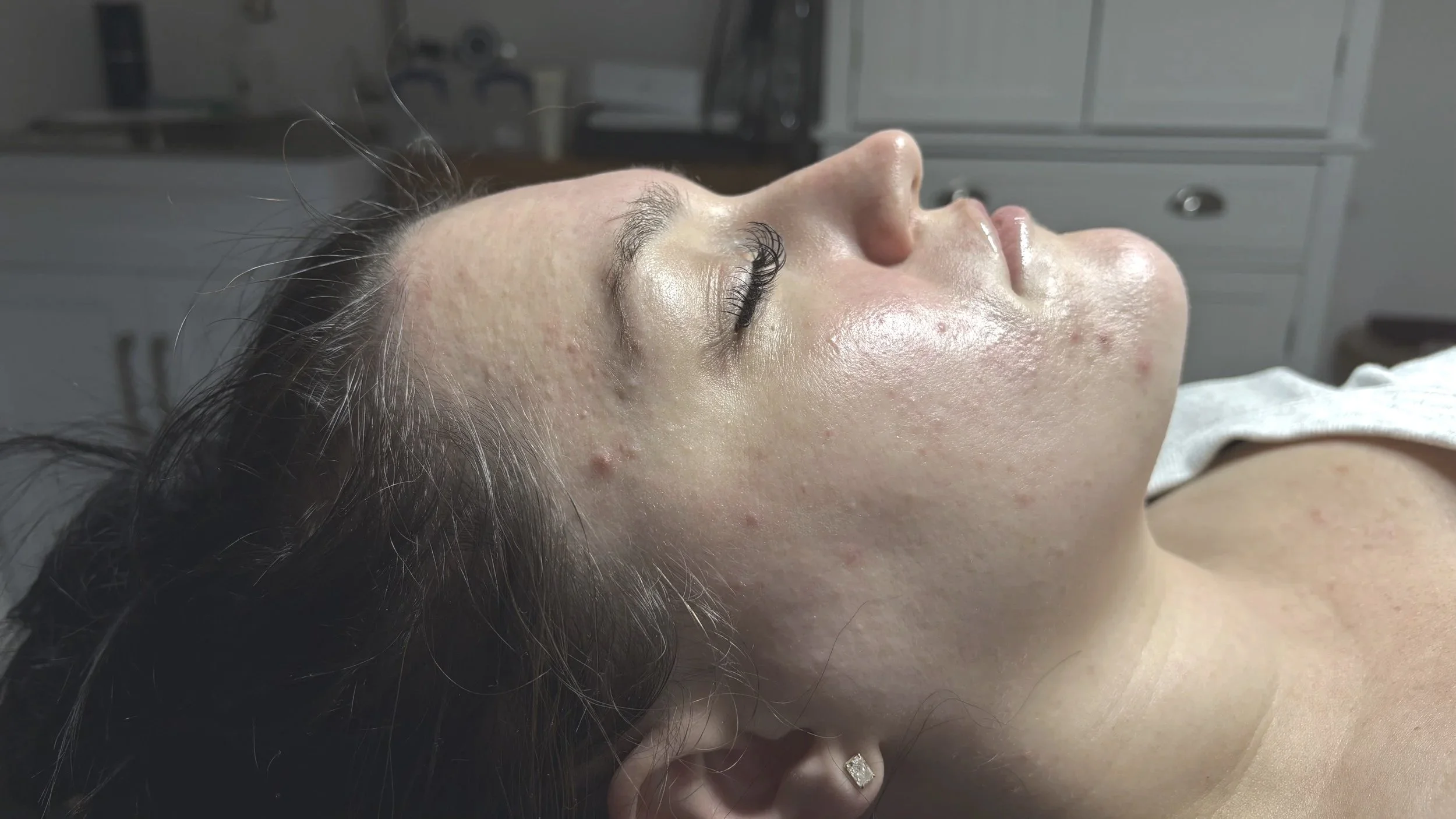 Dermaplane Pro performed by Master Ellie