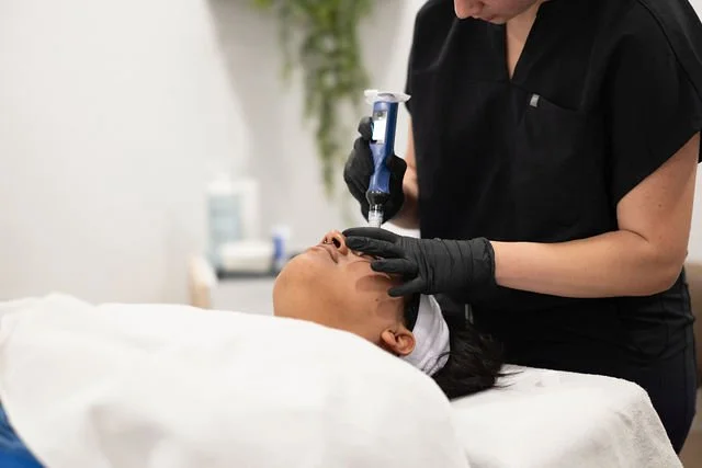 Skin Pen Microneedling performed by master Ireland 