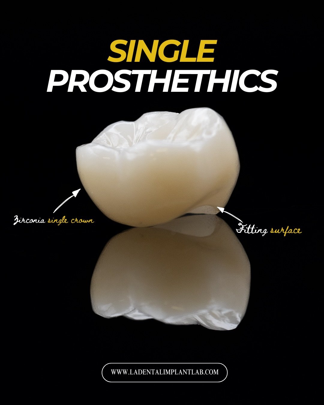 From single-unit restorations on implant abutments to crowns prepared for natural tooth cases, and even full sets of zirconia veneers, precision and consistency matter at every step.

Each prosthetic is designed with careful attention to fit, functio