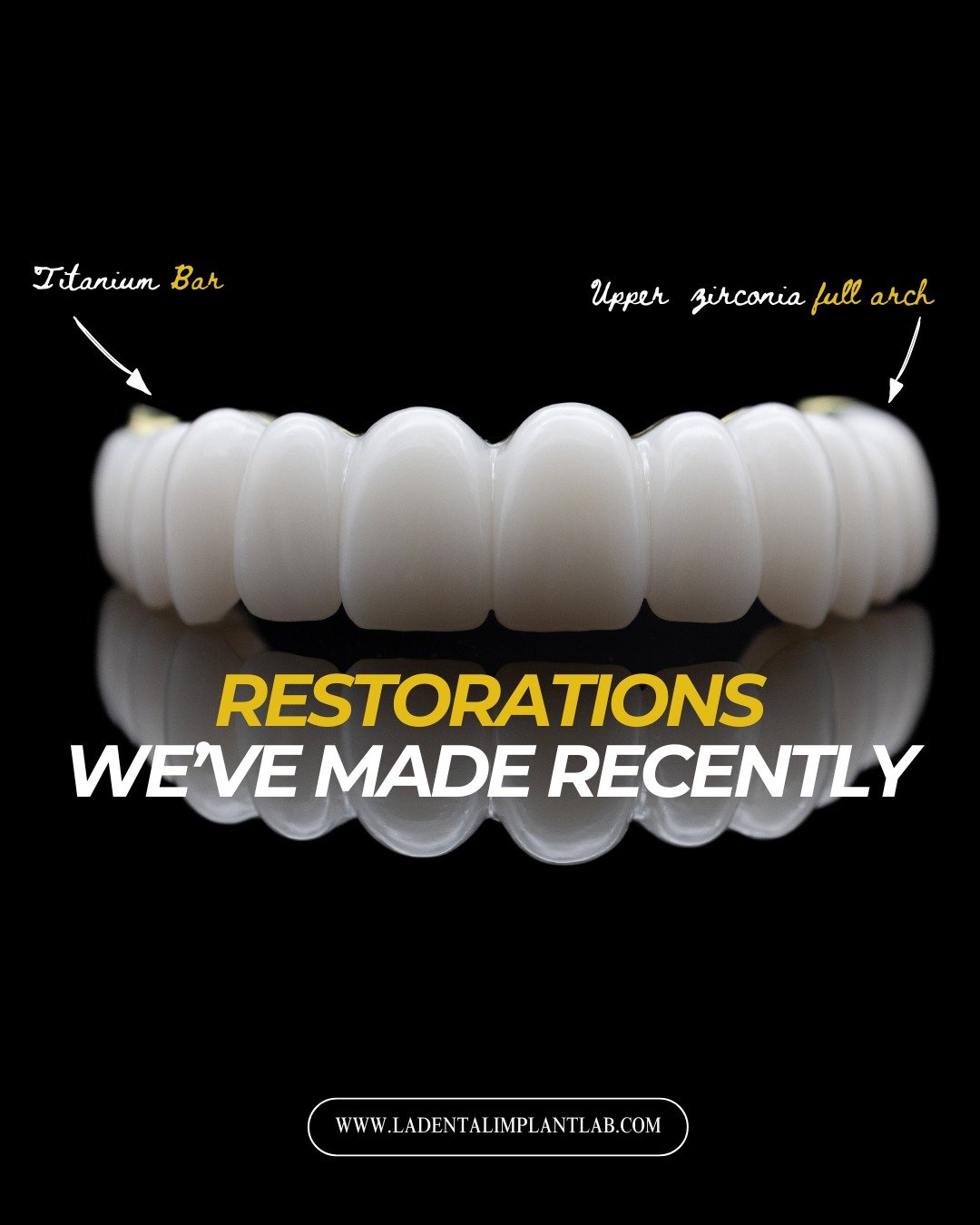 A look at recent full-arch restorations moving through the lab.

These cases feature a combination of FP1 and FP3 prosthetic designs across upper and lower arches, each selected based on tissue presentation, esthetic demands, and restorative space. F