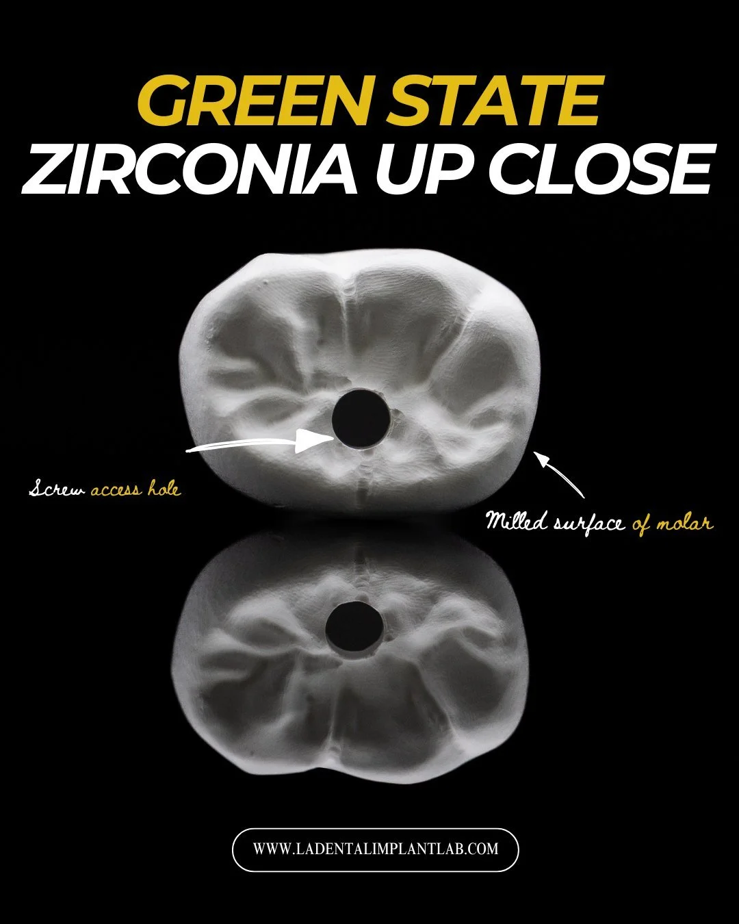 A closer look at precision before sintering.

This posterior crown showcases zirconia in its green state, prior to final sintering, where detail, contour, and surface characterization are carefully evaluated and refined. Milled from a single zirconia