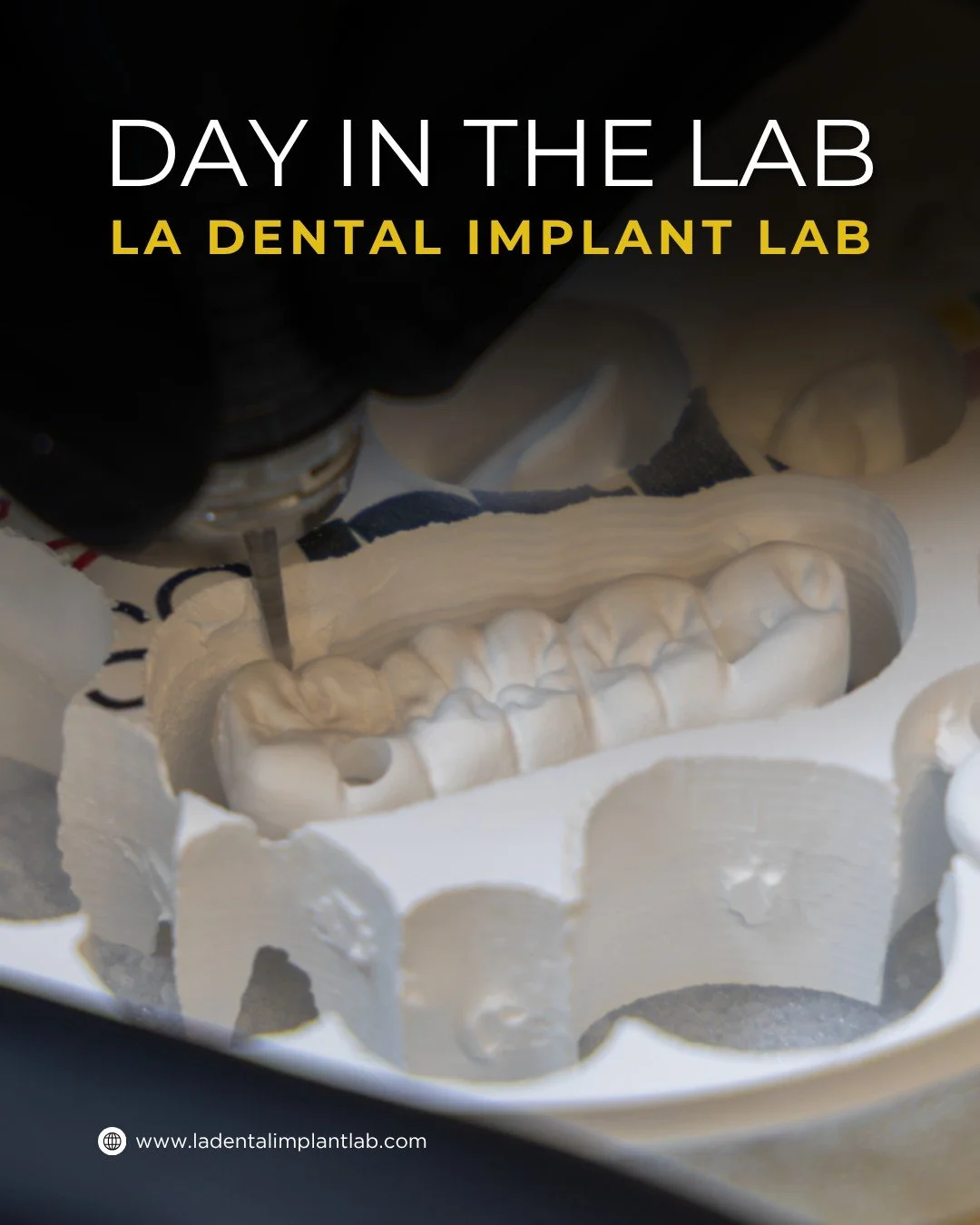 Every day in the lab looks a little different, but precision stays the same.
From individual crowns in PMMA, e.max, and zirconia to healing arches and implant-supported restorations, every case requires its own level of detail and customization. Diff