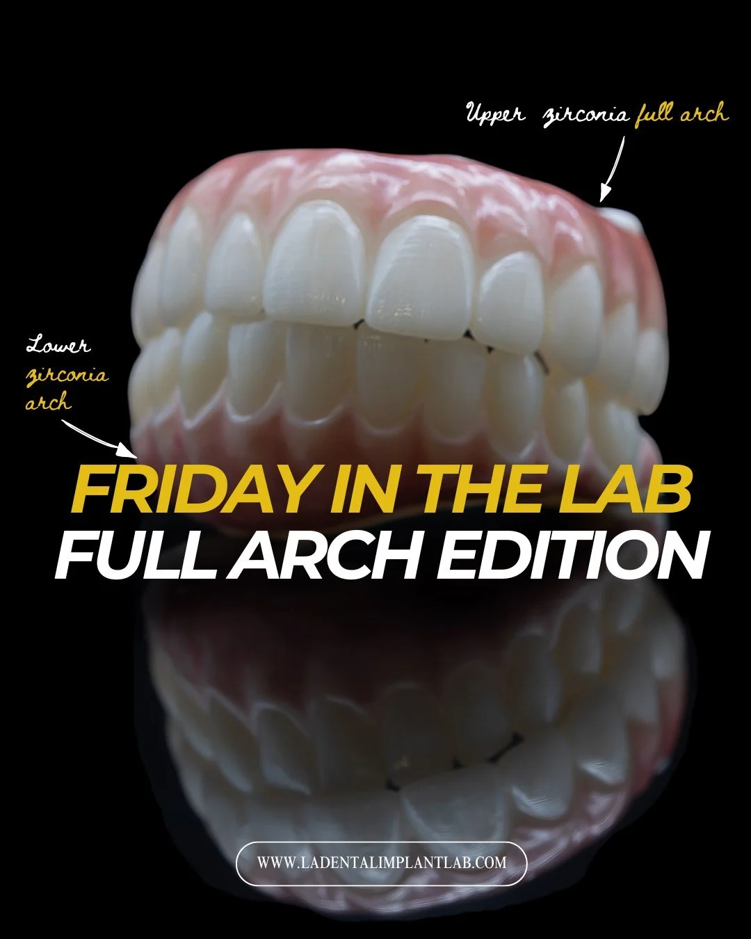 Full-arch dentistry is never one-size-fits-all.

From FP1 and FP3 restorations to provisional PMMA healing arches and final zirconia prosthetics, every case requires the right treatment plan, material selection, and restorative design for that specif