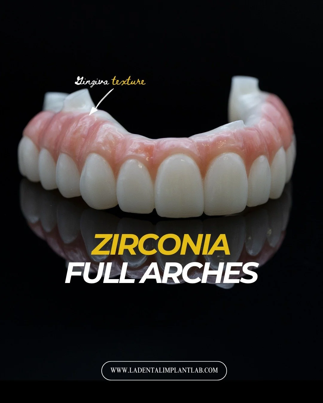 Full arch restorations require precision at every stage of the workflow.

From prosthetic design to milling and final finishing, each case is built custom to your patients. This carousel highlights several full arch restorations recently completed th