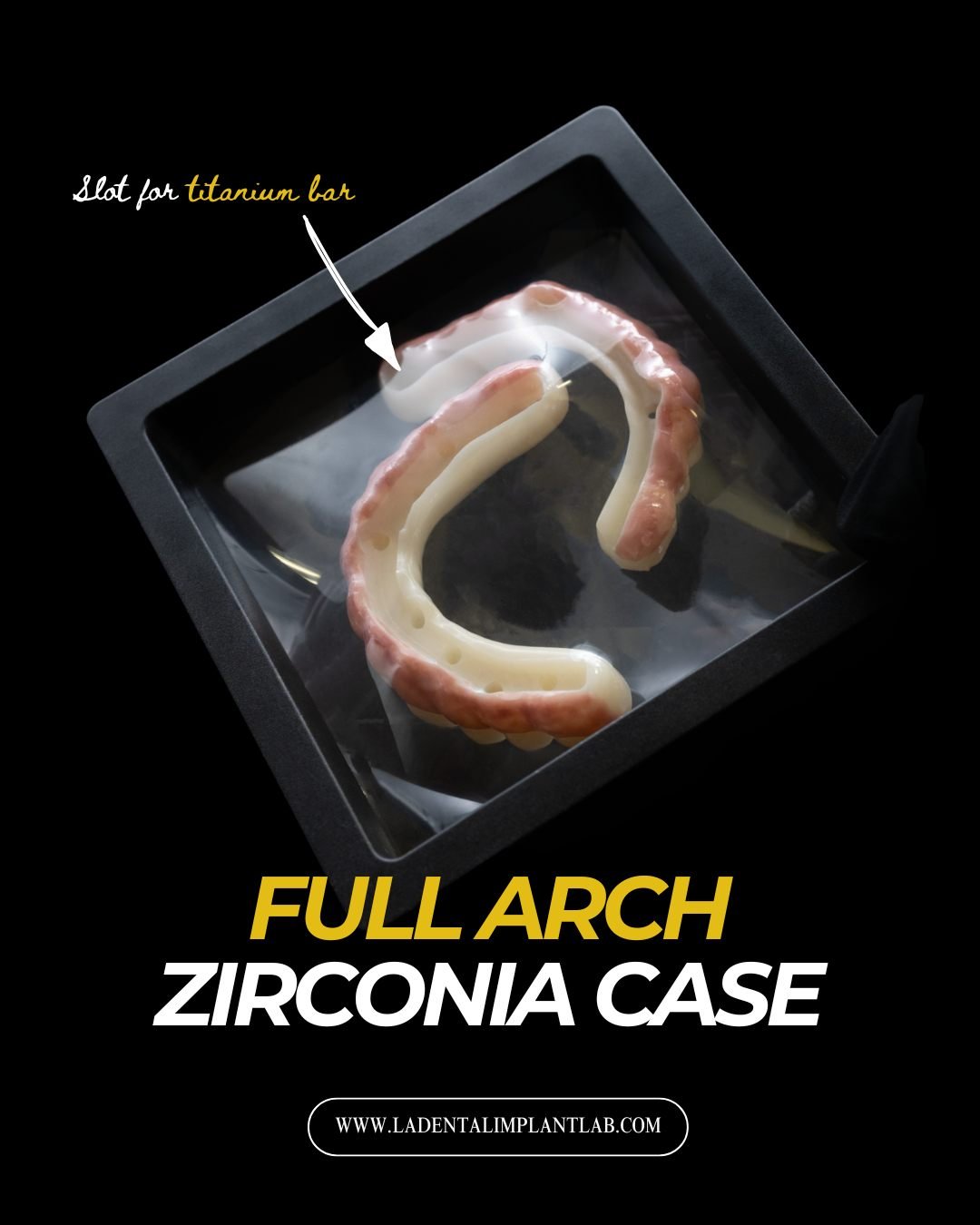 Precision meets aesthetics in this full arch zirconia case. These FP3 zirconia arches were designed and crafted to deliver strength, function, and lifelike characterization for the final restoration.

From custom gingival contouring and texture to la