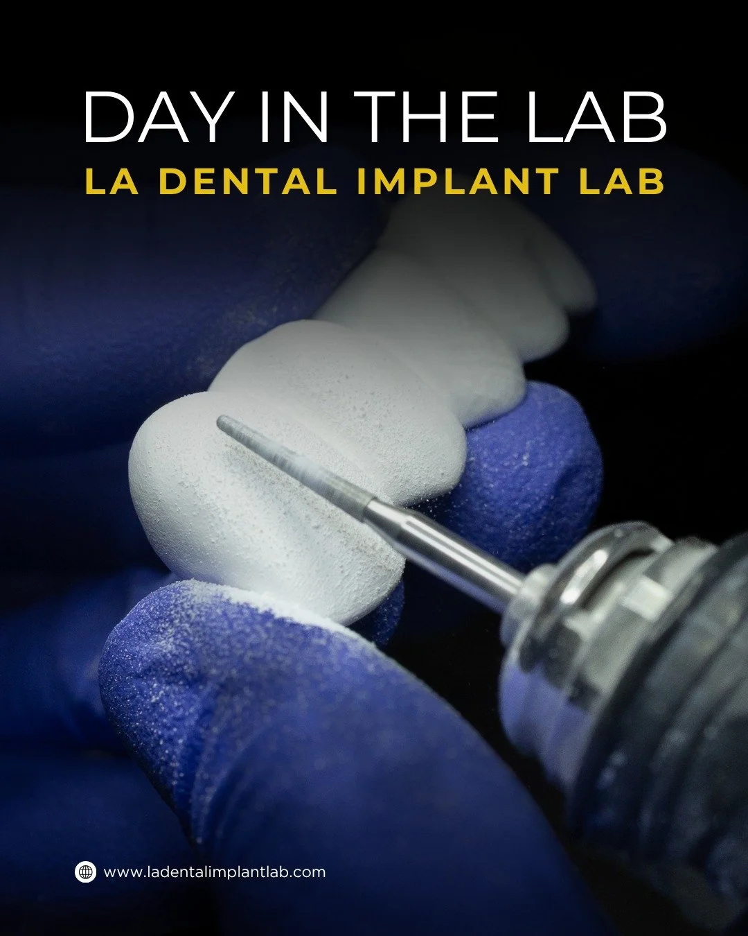A day inside the lab.

From PMMA dentures fresh off the mill to zirconia arches in final QC and custom zirconia crowns being milled, every case that moves through our lab is built with precision, consistency, and attention to detail.

Digital workflo