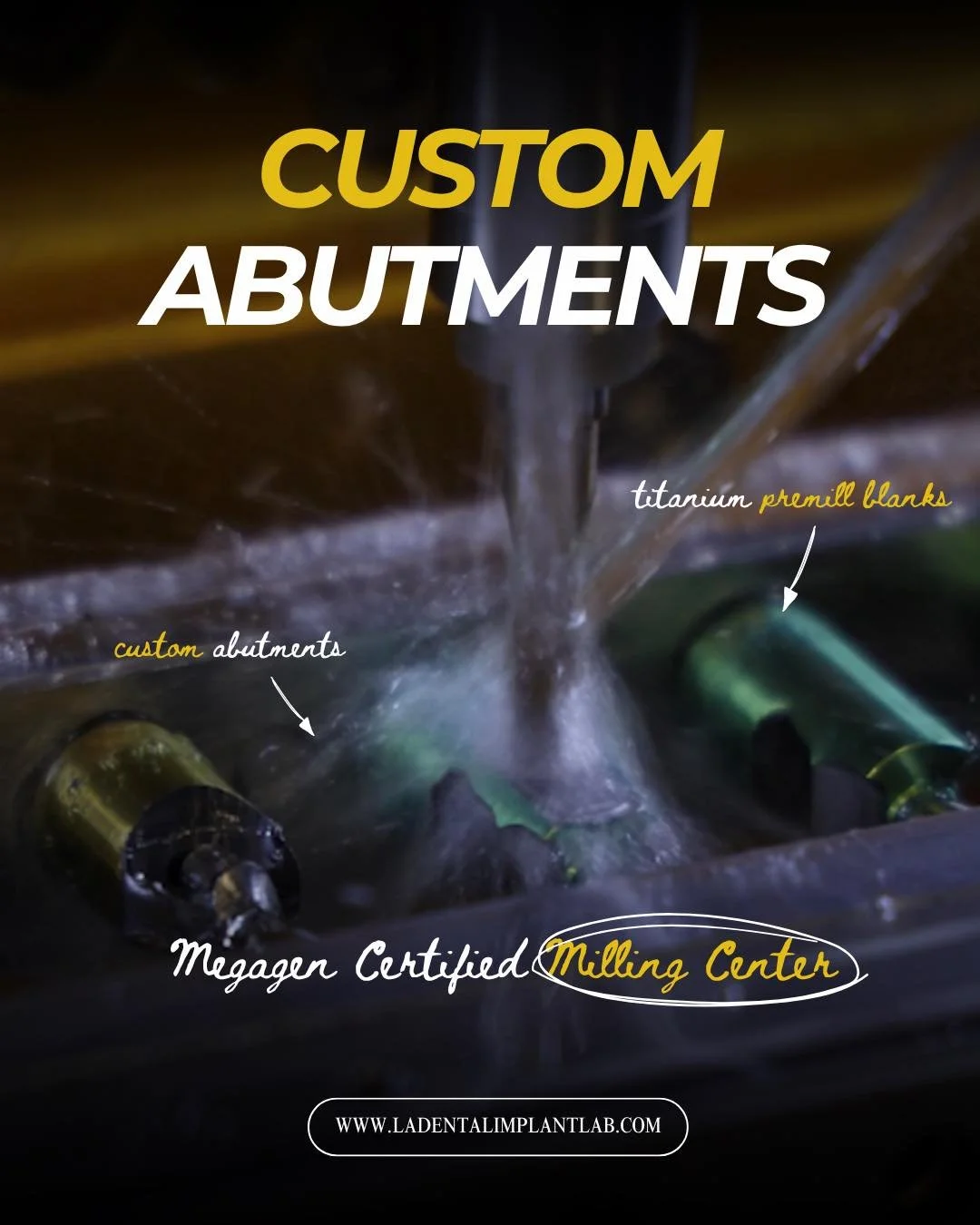 Custom abutments engineered for precision restorative outcomes.

As a MegaGen Certified Milling Center, LA Dental Implant Lab designs and mills custom abutments specific to each individual restoration. Every case is digitally planned to support ideal