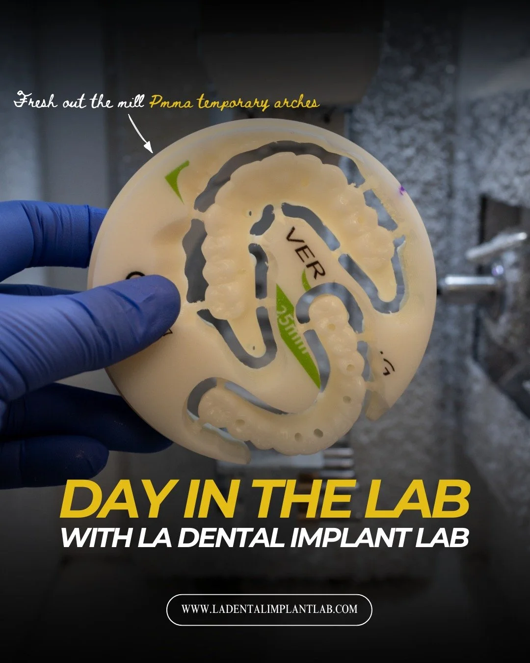 From full-arch zirconia to PMMA provisionals, every restoration that leaves our lab goes through detailed finishing and final QC before delivery. Precision milling, esthetic characterization, and restorative accuracy remain at the center of every cas