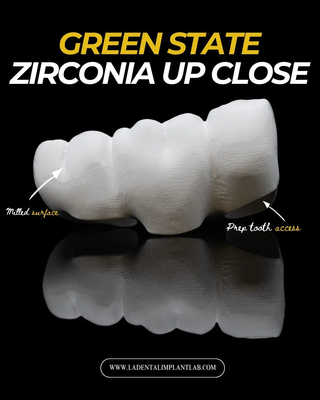 Precision starts long before sintering.

Here&rsquo;s an up-close look at zirconia in its green state. The critical stage where accuracy, anatomy, and surface refinement are established before final densification. In the pre-sintered phase, zirconia 