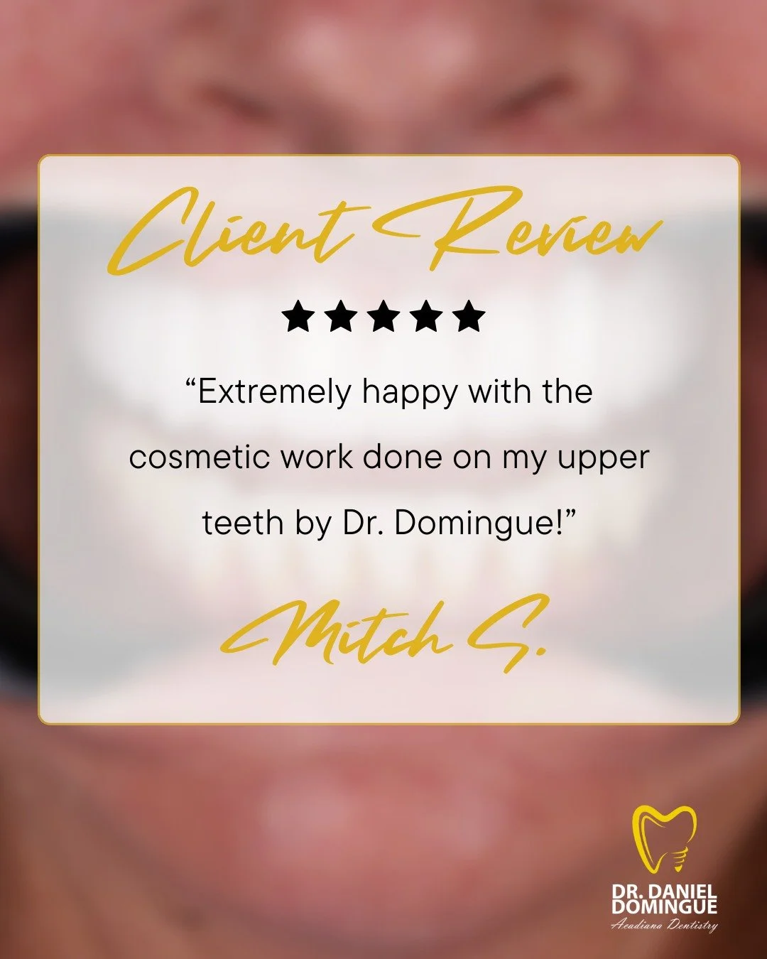 &ldquo;Extremely happy with the cosmetic work done on my upper teeth by Dr. Domingue.&rdquo;

Nothing means more to our team than helping patients feel confident in their smile again. We are grateful for the trust our patients place in us and proud t