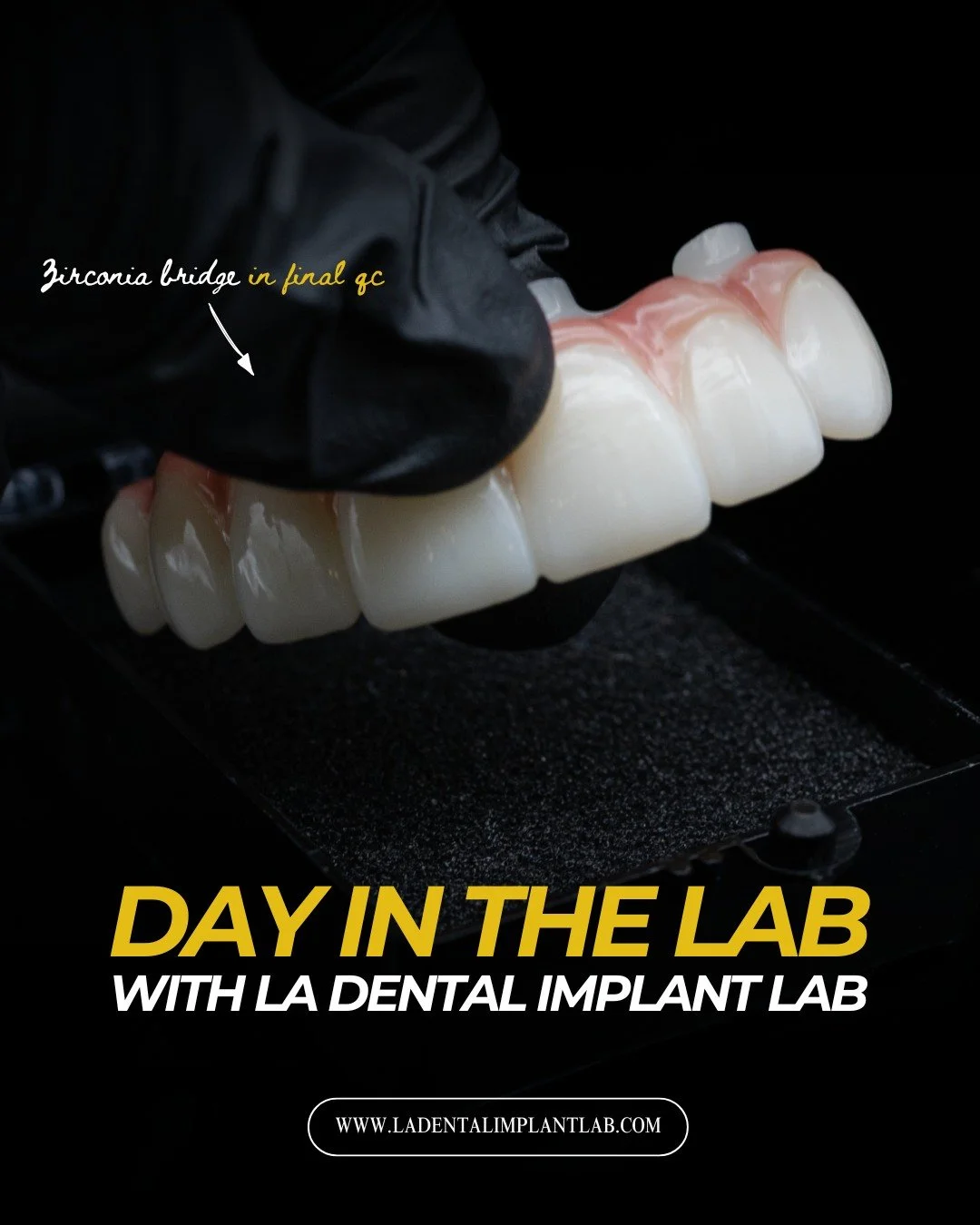 Every successful restoration is the result of a carefully managed workflow.

Today's look inside the lab highlights several critical stages of production, from quality control inspections and final packaging to zirconia restorations prepared for gree
