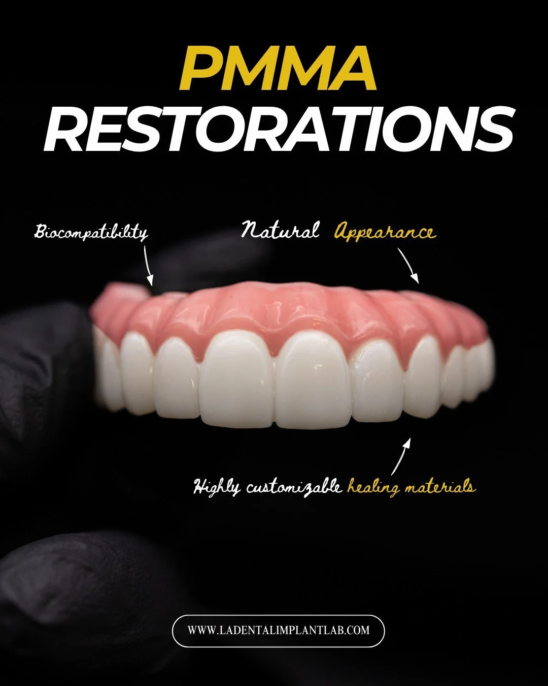 PMMA remains one of the most versatile materials in implant dentistry, particularly during the healing and transitional phases of treatment.

Lightweight, cost-effective, and highly adaptable, PMMA prosthetics provide patients with immediate function