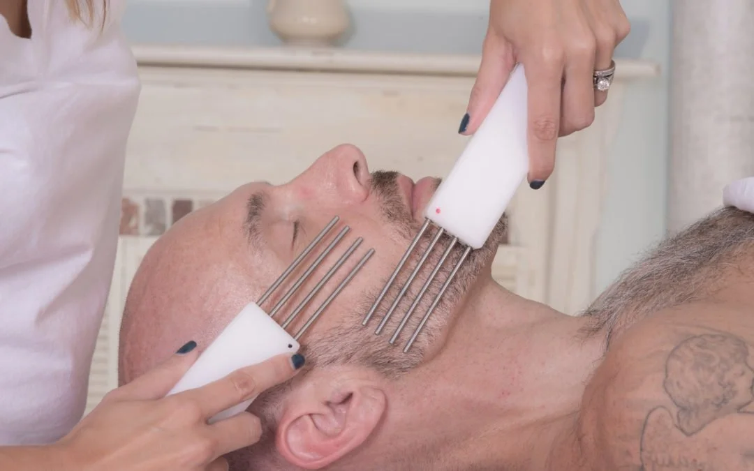 A man lying on his side with closed eyes, receiving a facial acupuncture treatment with fine needles inserted into his face, while a practitioner uses a white tool with metal prongs to stimulate his chin and cheek area.