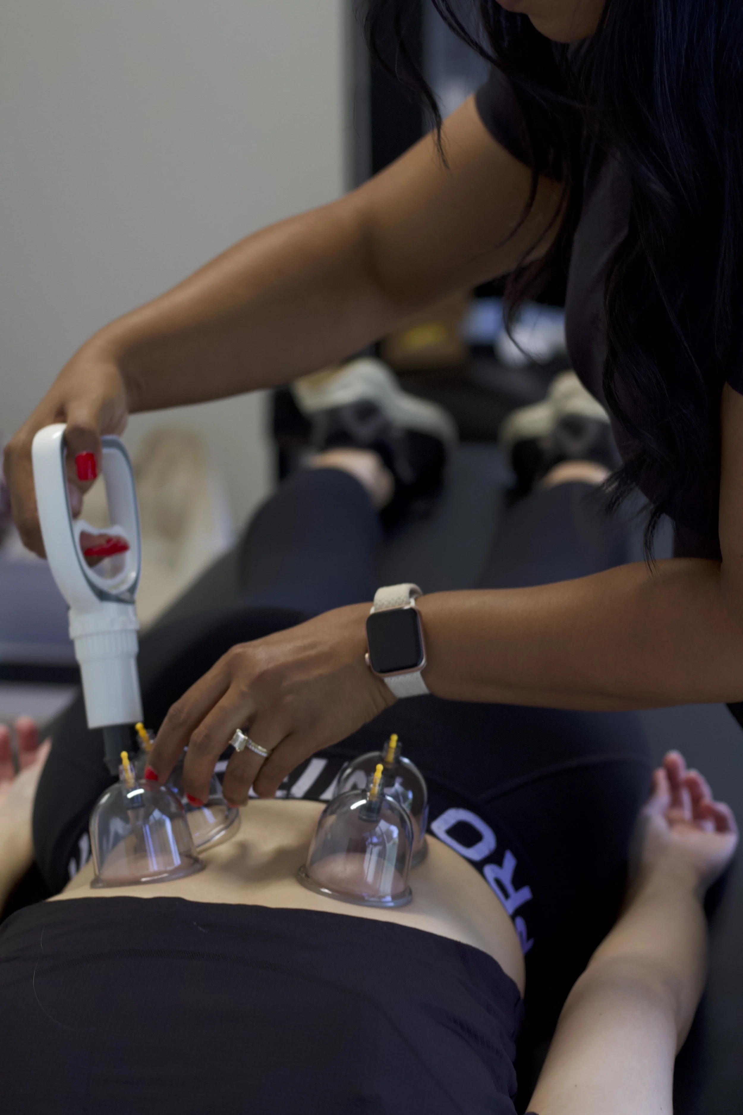 A woman is lying on a table with several glass cupping therapy cups on her abdomen. Another woman is applying a device connected to a tube to the cups for therapy, possibly cupping or vacuum therapy.