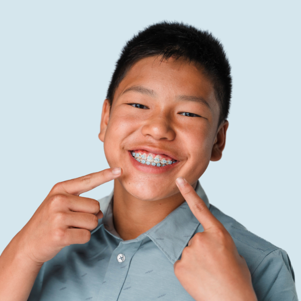 Smiling boy with braces pointing to his smile, wearing a gray shirt, in front of a light blue background.
