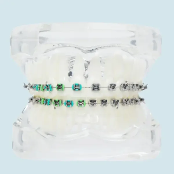 Close-up of a person's mouth with braces on their teeth, with an orthodontist using a dental tool near the braces.