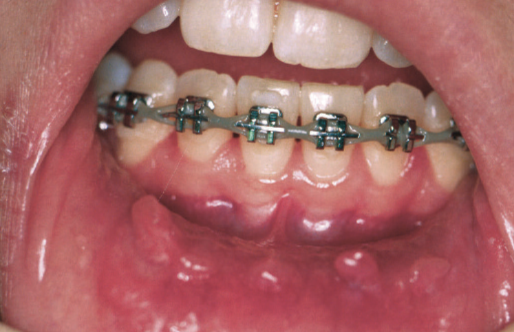 Screen Shot 2016-07-03 at 9.45.05 PM.png