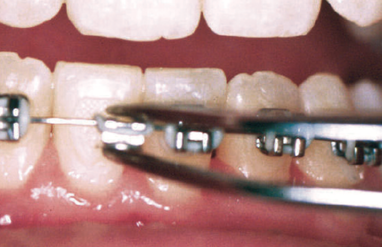 Screen Shot 2016-07-03 at 9.43.43 PM.png