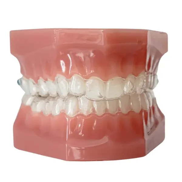 Invisalign clear aligner treatment at Team Braces
