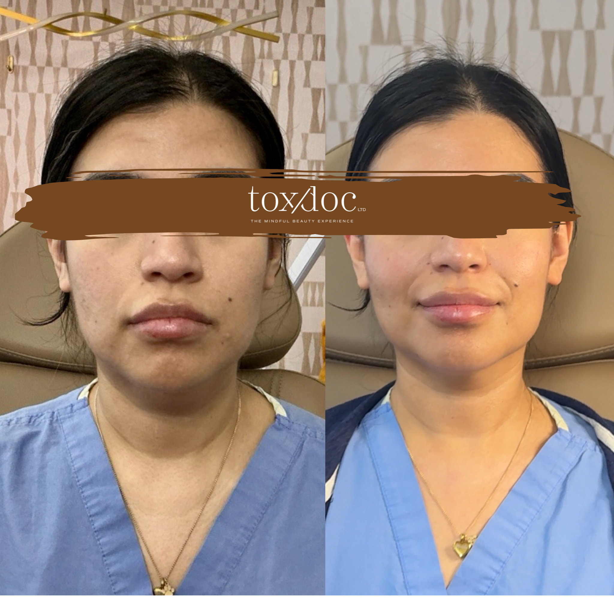 The Mindful Beauty Experience™: A physician-led full facial balancing experience integrating aesthetic medicine with whole-person wellness. Treatment focus includes full-face neuromodulation, trap tox for muscular tension relief, DAO correction, Nefe