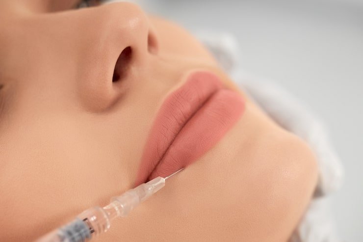 Close-up of a woman receiving a lip injection with a syringe during a cosmetic procedure.