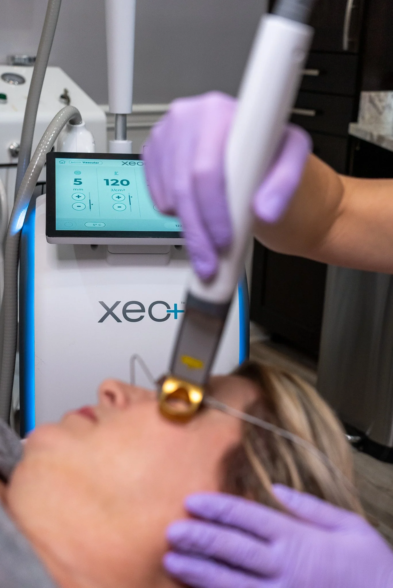 Medical professional in purple gloves performs a procedure on a patient's face in a clinical setting, with medical equipment and a digital monitor displaying settings in the background.