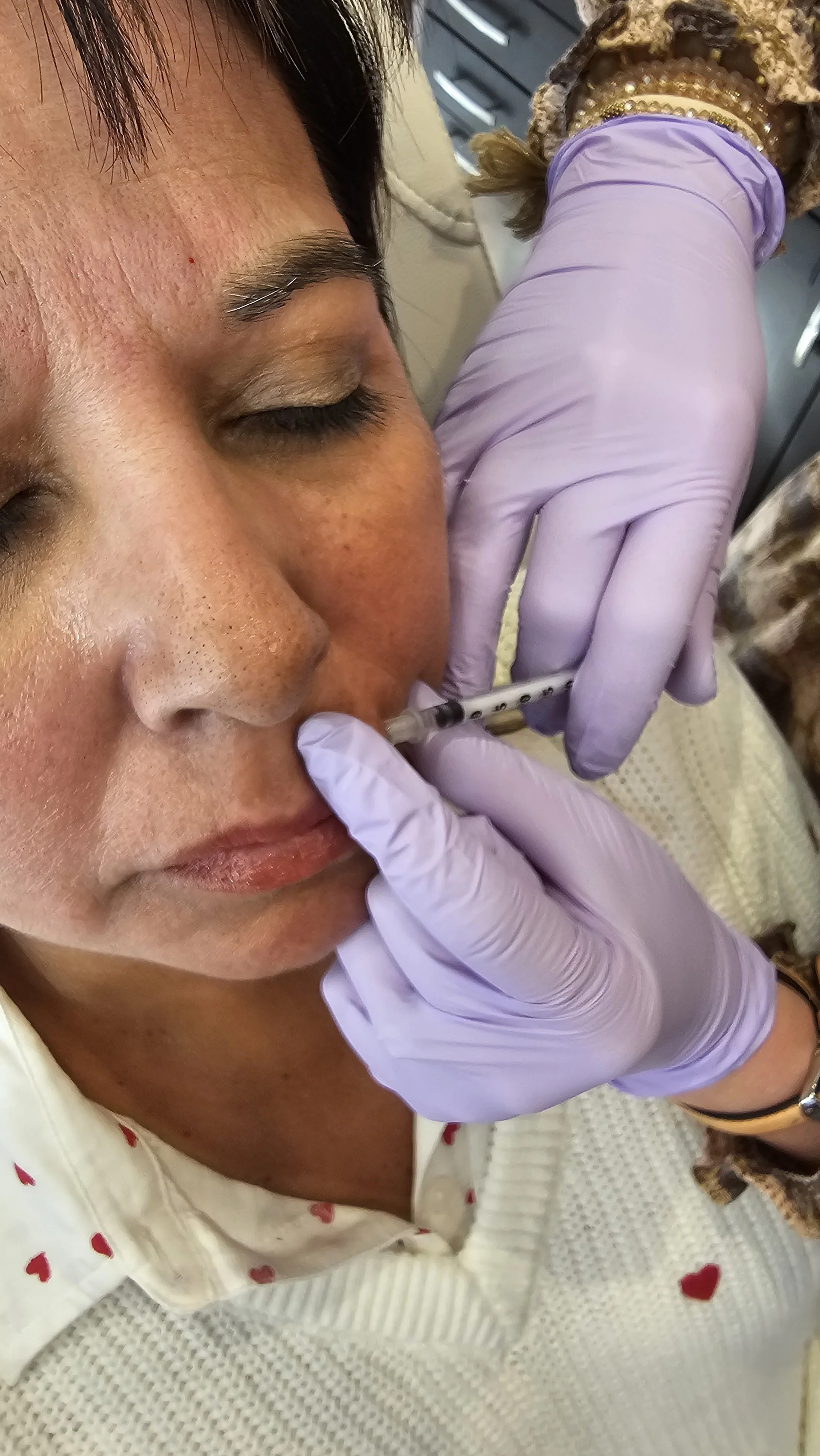 Close-up of a woman with closed eyes receiving a nasal injection from a healthcare professional wearing purple gloves, wearing a white sweater with red hearts, in a clinical setting.
