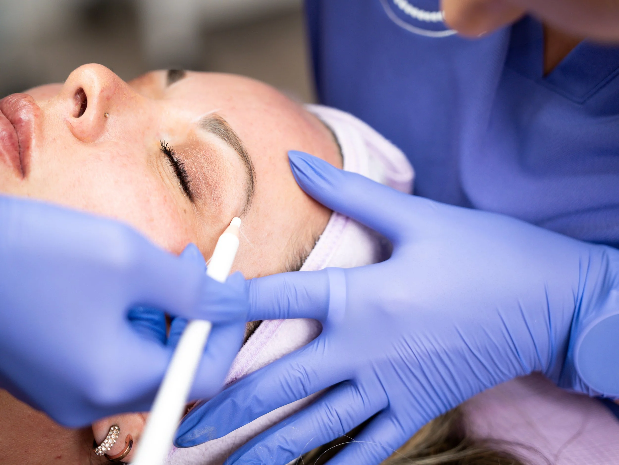 Close-up of a woman lying down during a cosmetic or medical procedure, with a healthcare provider in blue gloves applying treatment near her face fitting into the nose and cheek area.
