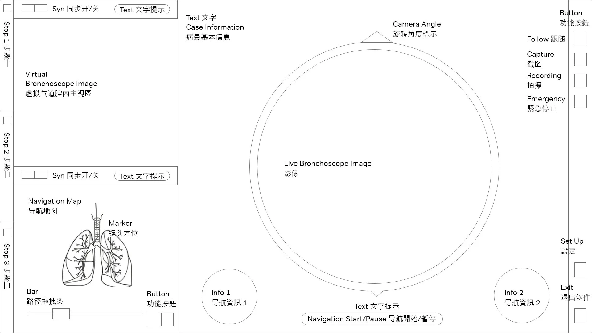 A detailed diagram of a medical interface for a virtual bronchoscope system, with sections for case information, camera angles, live images, navigation map, and controls for capture, recording, and emergency stops, labeled in both English and Chinese.