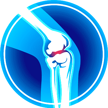 Illustration of a human knee joint with some pain indicated.
