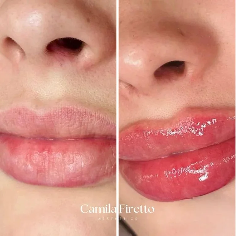 lips0426_3.jpeg