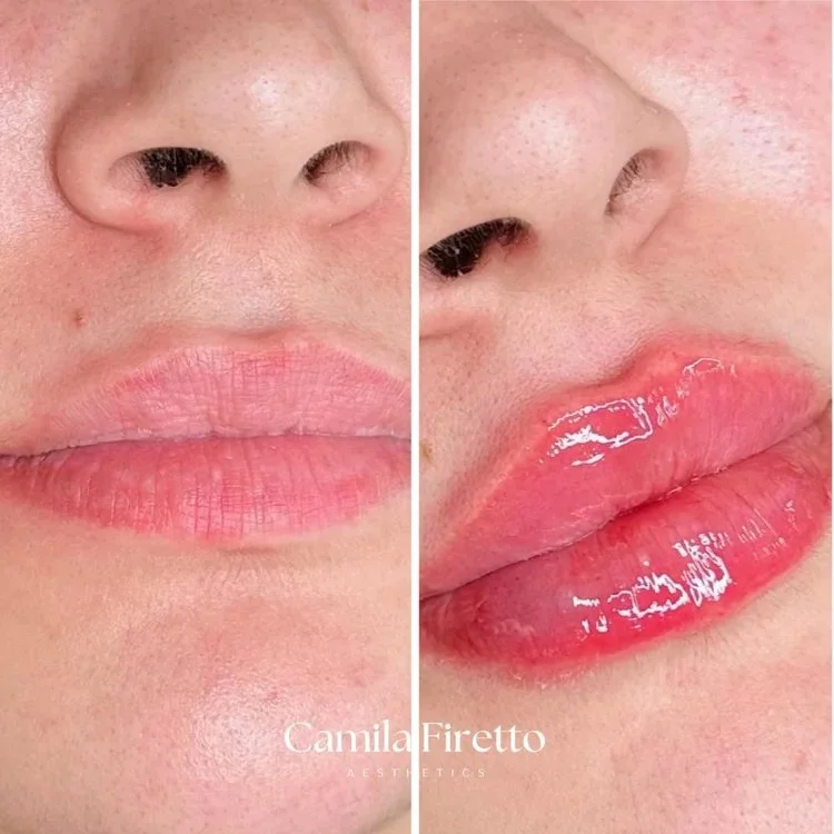 lips0426.jpeg