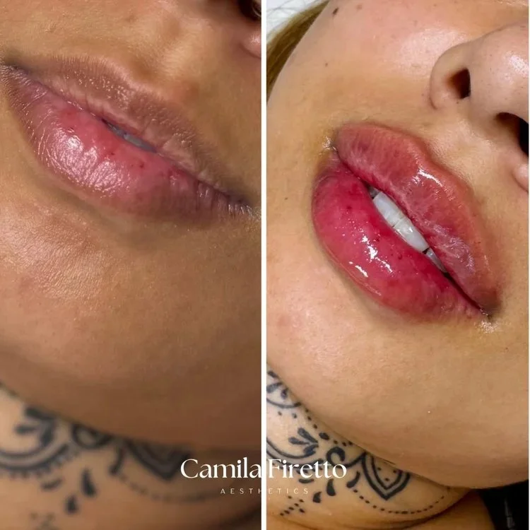 lips0426_1.jpeg