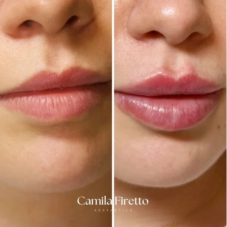 lips0426_2.jpeg