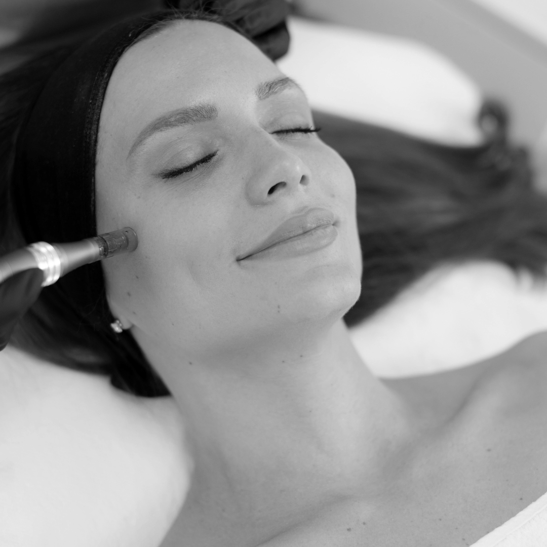Medspa in Traverse City, MI, 49684 | Microneedling Near Me