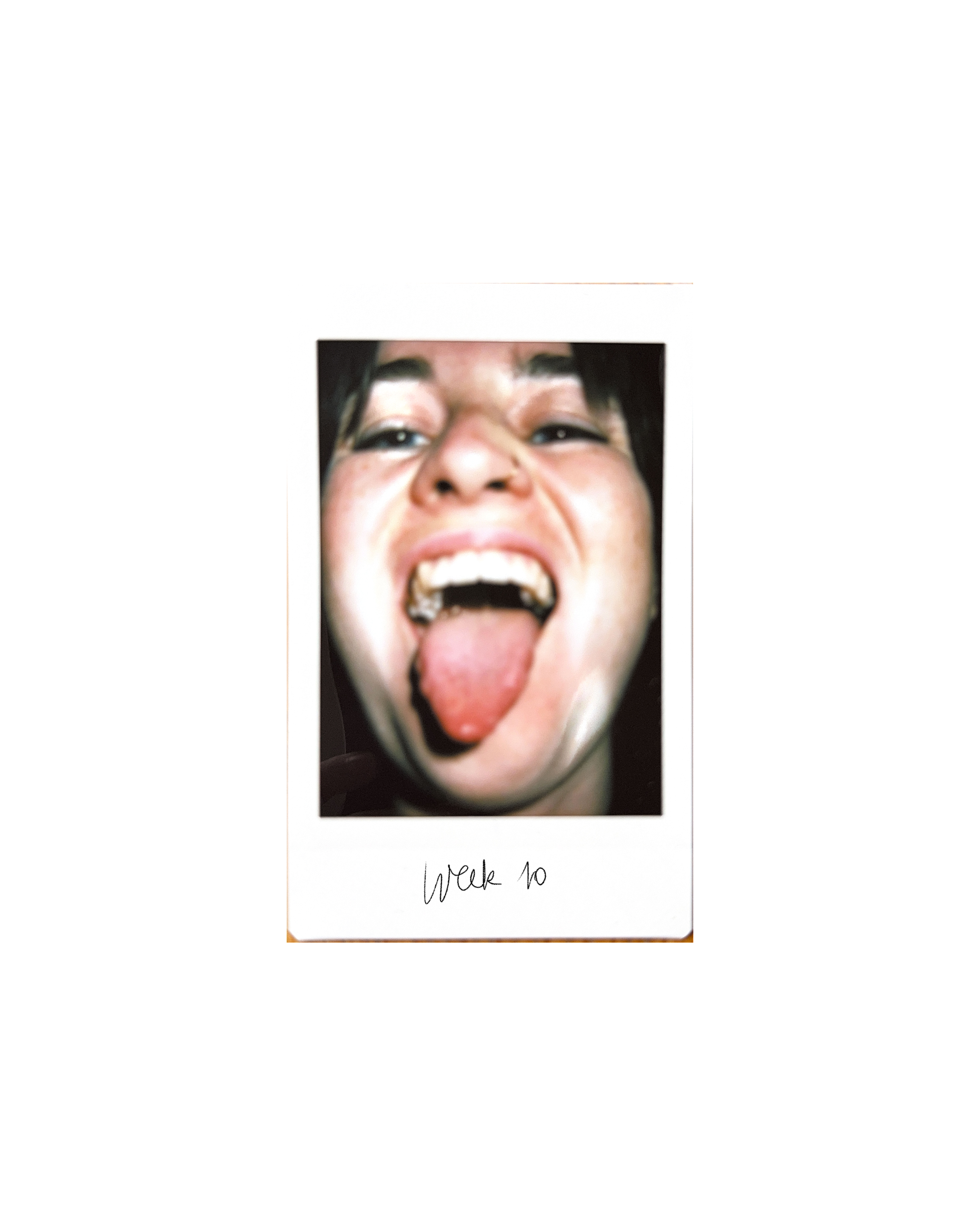 Mouth