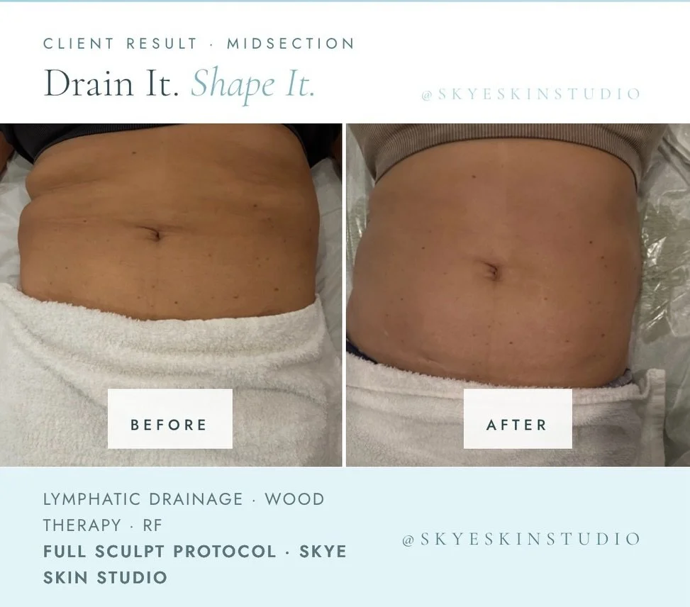Real client. Real results. 

Let me guess&hellip;

You&rsquo;ve tried every diet, every exercise and workout routine possible 

But still feel bloated, that heaviness that won&rsquo;t come off no matter what you do? 

So did my client..until she saw 