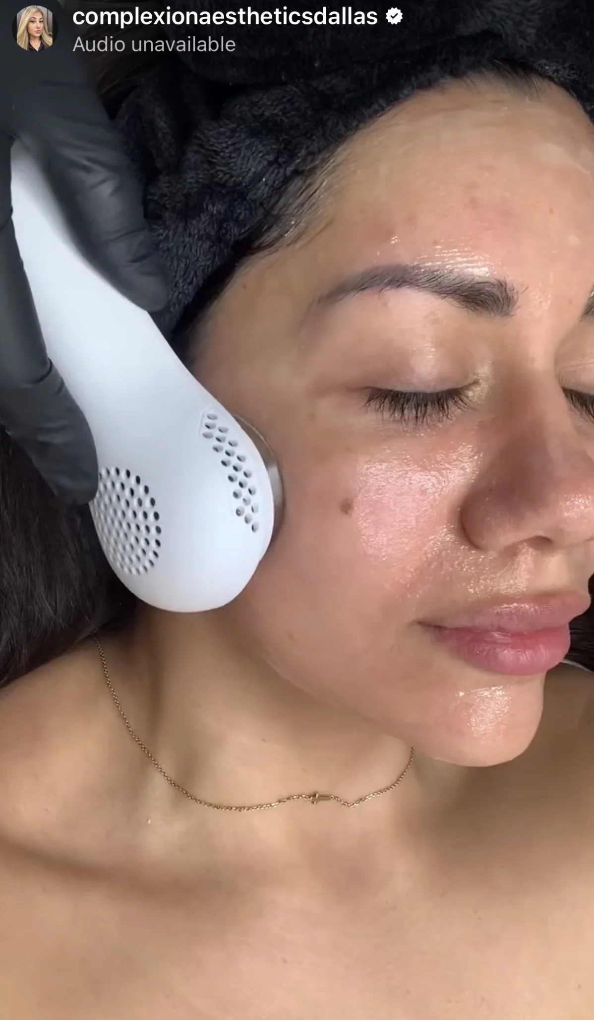 Close-up of a woman receiving a facial treatment, with her eyes closed, wearing a black headband, and a gold necklace. A professional in black gloves is using a white device on her face.