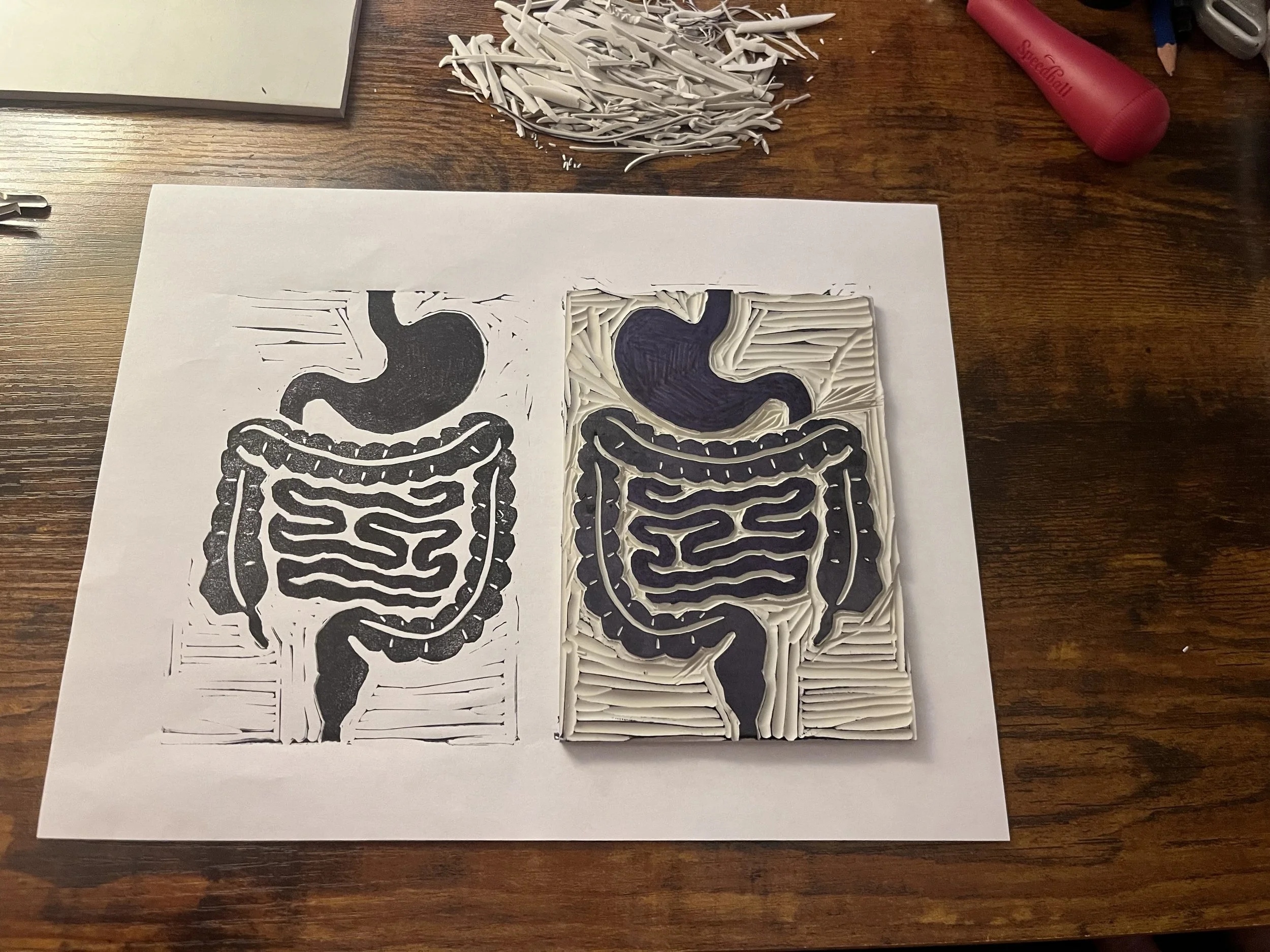 Gastroenterology, 2025