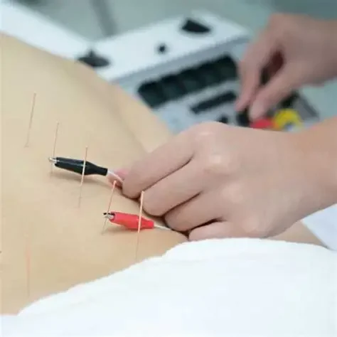 Electroacupuncture