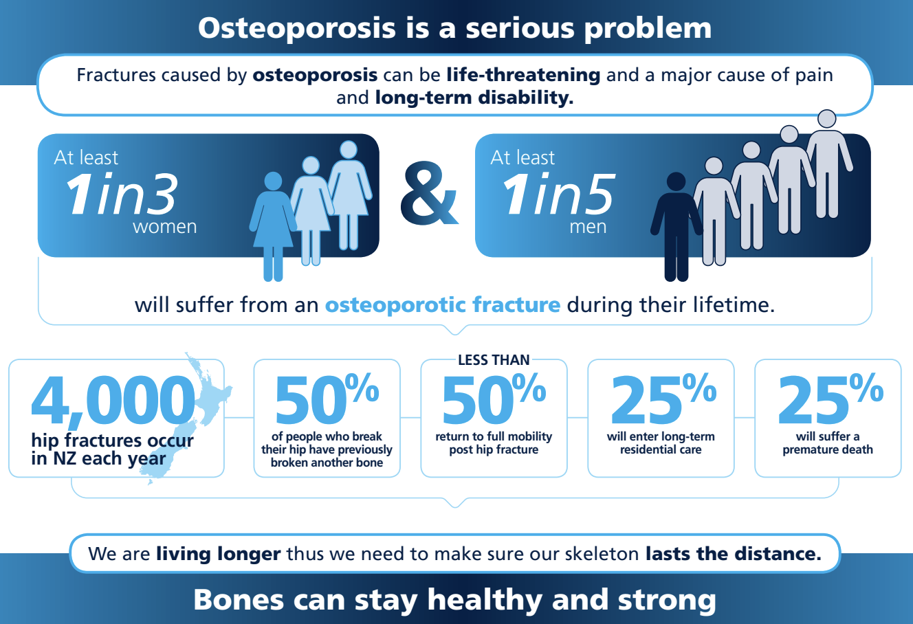Infographic about osteoporosis highlighting risks for women and men, with statistics on hip fractures in New Zealand, and emphasizing the importance of bone health for longevity.