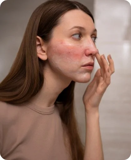 Redness, rosacea and reactive skin