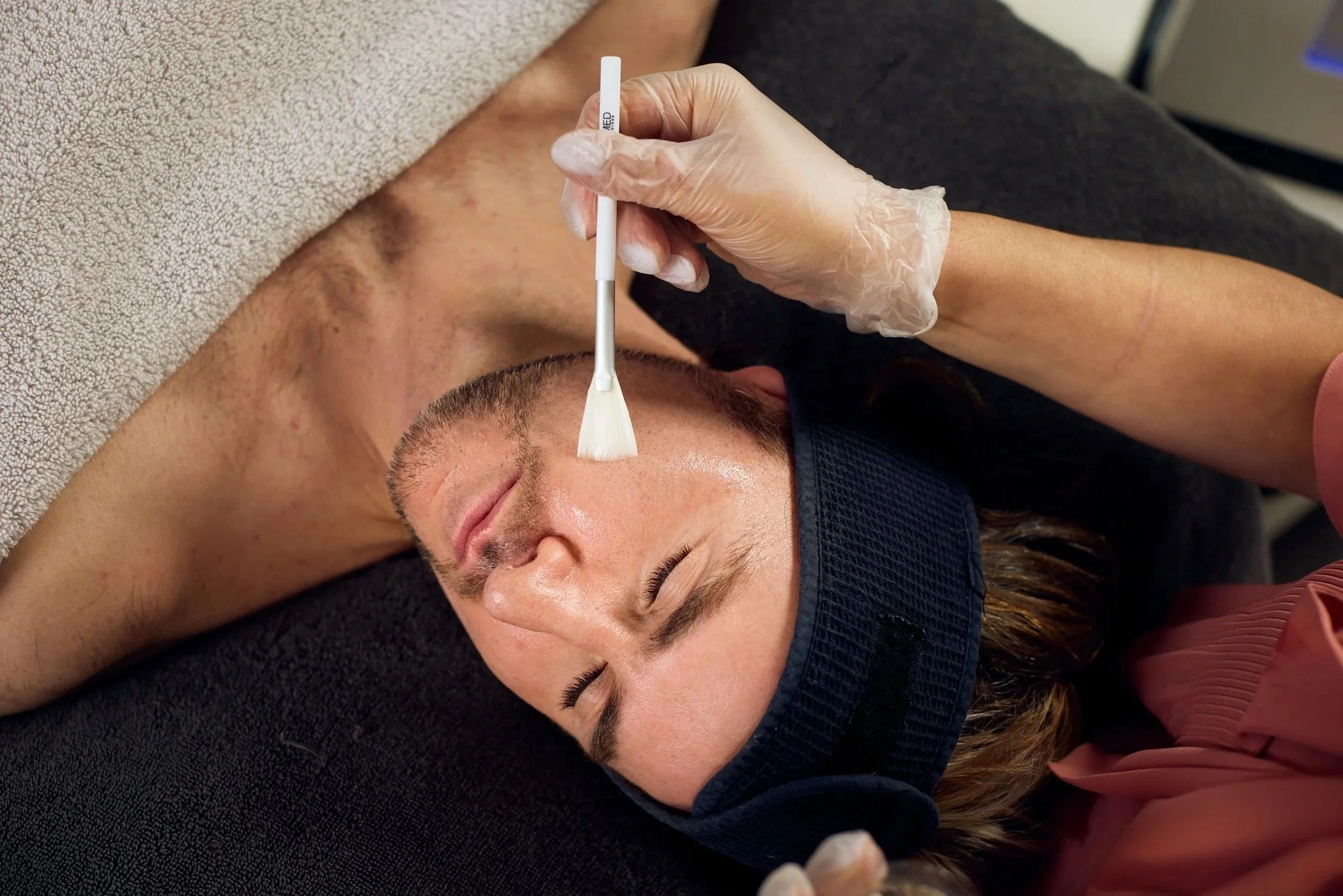 Meline Pigmentation Peel