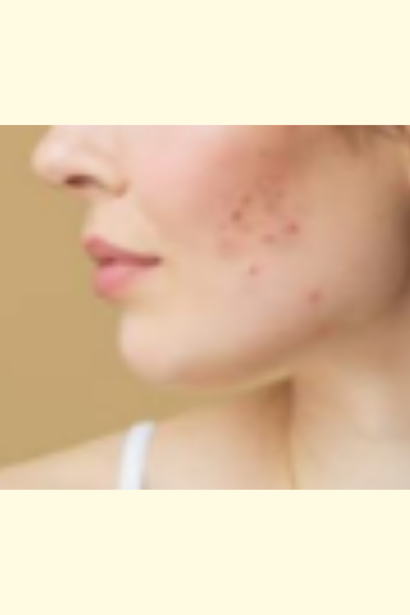 Post-Summer Skin Treatments: Restore Radiance and Fade Pigmentation Naturally