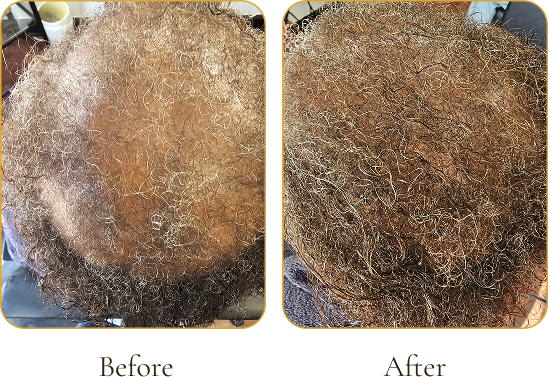 Comparison of a person's scalp before and after a hair treatment, showing increased curl pattern and hair density in the after image.