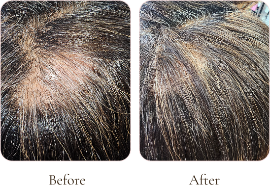 Comparison of a person's scalp showing before and after hair coloring or highlighting, with visible hair strands and roots.